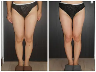 小顔専門店 グレイスボディ三郷店のエステ・リラクイメージ