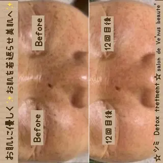 ヴィーナス ビューティーのエステ・リラクイメージ