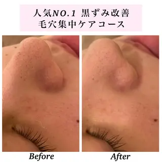 Bellesthe （ベルエステ）のエステ・リラクイメージ