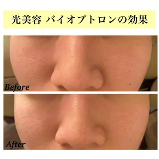 Bellesthe （ベルエステ）のエステ・リラクイメージ