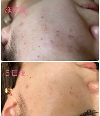 N.style所属・Ｎ. styleのネイルデザイン