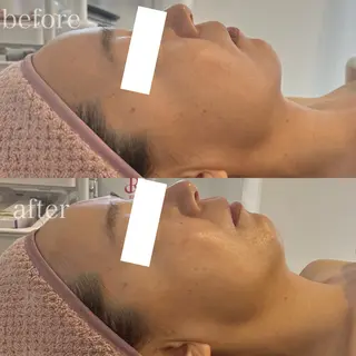 Le cherienのエステ・リラクイメージ