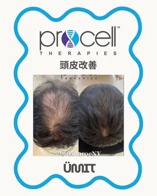 メンズ Ümit（ユミト） プロセルセラピーズのネイルデザイン