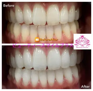 ショート カラー パーマ ヘアアレンジ メンズ キッズ ネイル マツエク・マツパ アイブロウ AILINDA  BEAUTY所属・アイリンダ ビューティーのエステ・リラクイメージ