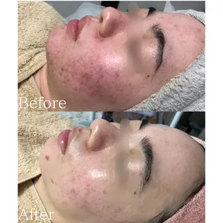 肌質改善サロン BestBelleのエステ・リラクイメージ