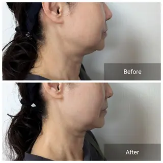 nail RiRi アトレナチュラのエステ・リラクイメージ