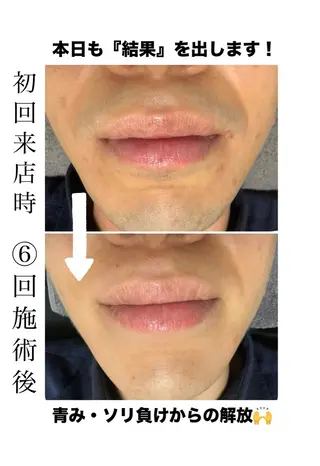 メンズ メンズ脱毛サロン Le falcoのエステ・リラクイメージ