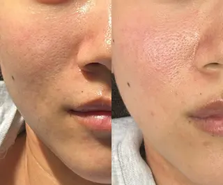 GRACIA刈谷店所属・ＧＲＡＣＩＡ 刈谷店のエステ・リラクイメージ