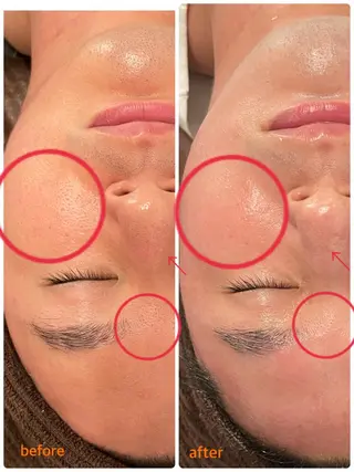 肌改善/まつげパーマ 🌙Luunaのエステ・リラクイメージ