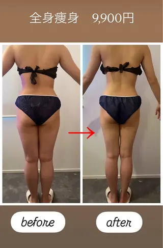 本気で痩せたい方へ 痩身専門サロンのその他イメージ
