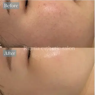 Rumia Salonのエステ・リラクイメージ