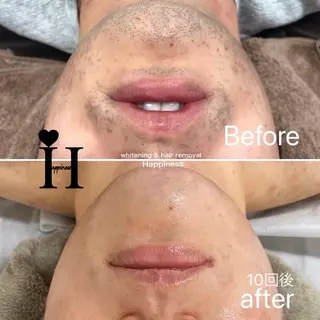 倉本(店長) ハピネス心斎橋本店のエステ・リラクイメージ