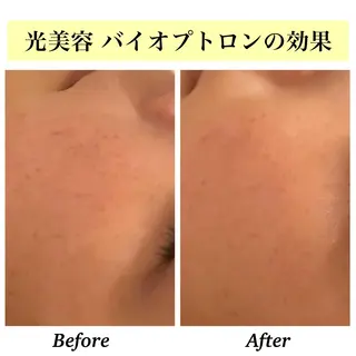 Bellesthe （ベルエステ）のエステ・リラクイメージ