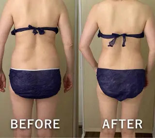 hitohana所属・毛穴/いちご鼻/小顔 /hitohanaのエステ・リラクイメージ