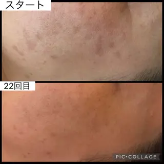 Bright所属・Brightブライト (エステ.リラク)のエステ・リラクイメージ