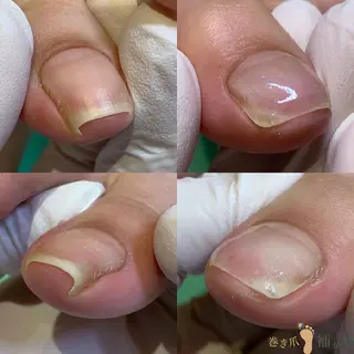 巻き爪補正店　柏店所属・巻き爪補正店 柏店のその他イメージ