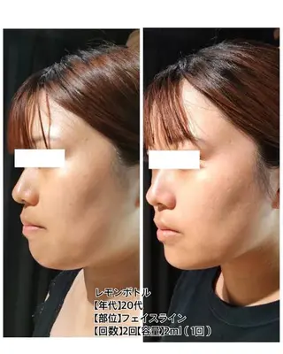 LIAN Beauty Salon所属・LIAN リアンのエステ・リラクイメージ