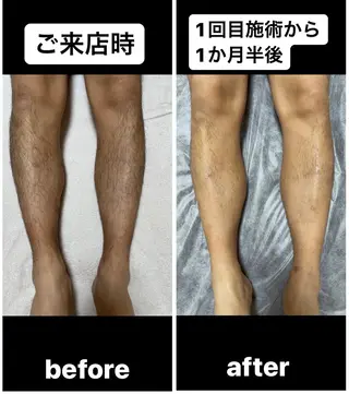 メンズ sourire所属・フェイシャルと脱毛 sourireのエステ・リラクイメージ