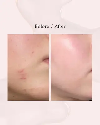 myherb所属・ニキビ肌改善サロン myherb🌿のエステ・リラクイメージ