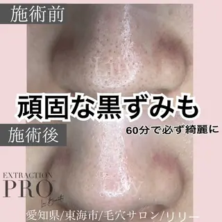 トータルビューティー サロンLilyのエステ・リラクイメージ