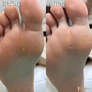 巻き爪補正店　町田店所属・巻き爪補正店 町田店のその他イメージ