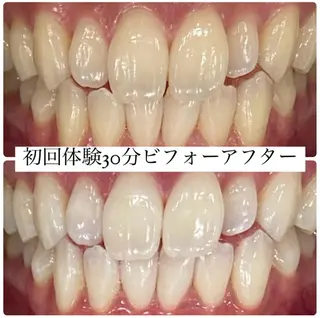 PLATINUM Beauty 横浜店所属・ホワイトニングルーム 横浜店のその他イメージ