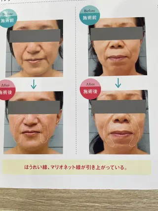 ビューティークリエイト所属・ビューティー クリエイトのエステ・リラクイメージ