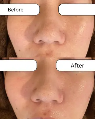 南森町・肌質改善 BELMIMARのエステ・リラクイメージ