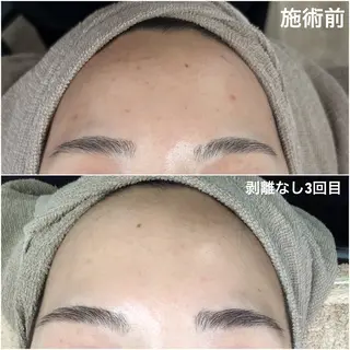 ハーブピーリング専門 エミルカ船橋のエステ・リラクイメージ