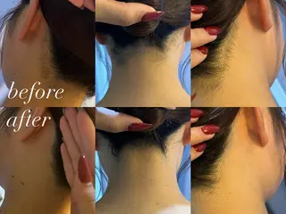 うなじ脱毛/美肌脱毛 LABELのエステ・リラクイメージ