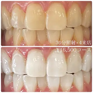 メンズ ホワイトニングルーム　川崎店所属・ホワイトニング ルーム　川崎店のその他イメージ