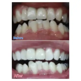 M渋谷店所属・M渋谷 ホワイトニングのエステ・リラクイメージ