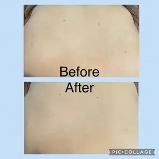 メナードフェイシャルサロン　茨木元町所属・メナード化粧品 茨木元町のエステ・リラクイメージ