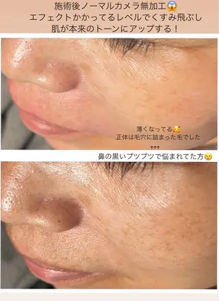 Beauty&Spa Sereno所属・beauty&spa Serenoの眉毛・アイブロウイメージ