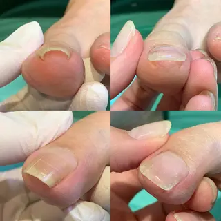 ネイル 東京巻き爪アカデミー所属・東京巻き爪 アカデミーのエステ・リラクイメージ