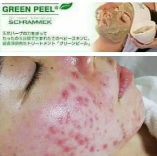 BB-Style所属・21周年愛されサロン マツエク&エステ矯正のマツエク・マツパデザイン