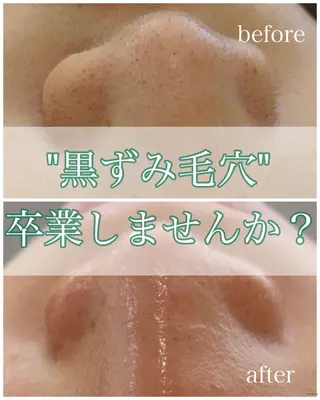 écla【中崎町】 yukikoのエステ・リラクイメージ