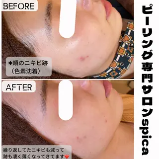 ピーリング専門サロン Spicaのエステ・リラクイメージ
