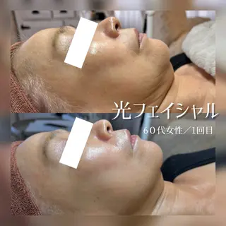 REJUSALON JURIのエステ・リラクイメージ