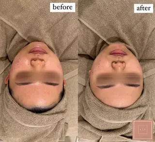 Ele所属・有田 佑佳のエステ・リラクイメージ