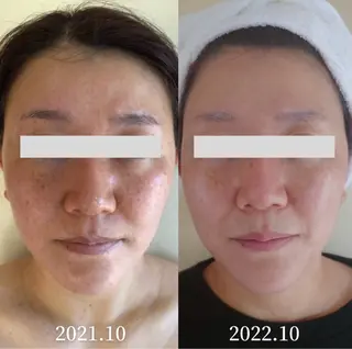 Esthe salon Blanche(エステサロンブランシュ)所属・小顔リフトアップ 美肌改善専門店のエステ・リラクイメージ