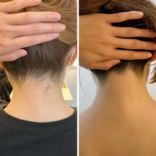 うなじ脱毛/美肌脱毛 LABELのエステ・リラクイメージ