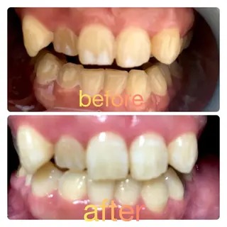 two nailのネイルデザイン