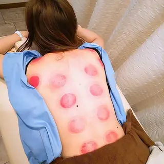 むくみたるみ専門☆ 美容鍼・小顔矯正のエステ・リラクイメージ