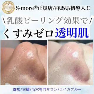 毛穴専門サロン ライカブルーのエステ・リラクイメージ