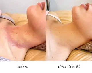 肌質改善🌿 彩也乃のエステ・リラクイメージ