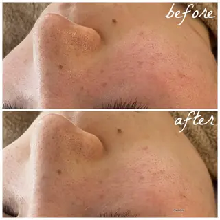 メンズ メナード岐阜市茜部 杉浦のエステ・リラクイメージ