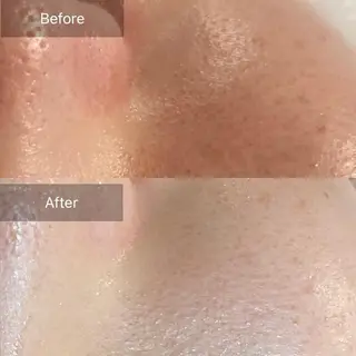 Mandarin Orange所属・毛穴から始める肌メン テマンダリンオレンジのエステ・リラクイメージ