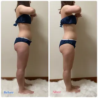 ACORAL痩身 NAZUKIのエステ・リラクイメージ