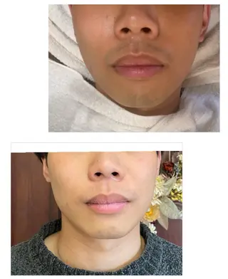 ネイル＆脱毛 Lotus🌸のネイルデザイン